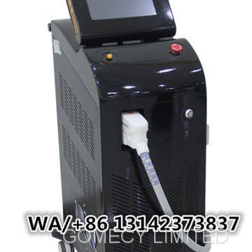 Best Alma Lasers Soprano ICE (the Hair Removal Solution) photo-2