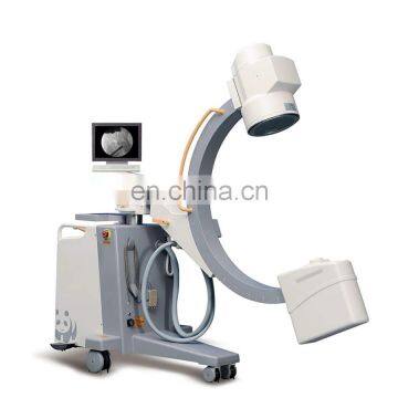 MY-D035B-N medical radiology equipment mobile c-arm x-ray machines digital