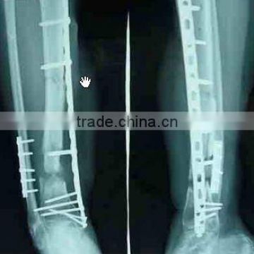 X ray thermal film, KENID medical x ray film with CE