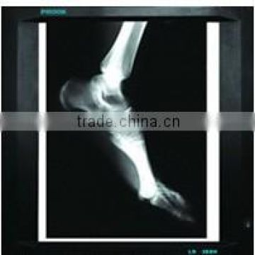 top quality and low price dry medical surgical film