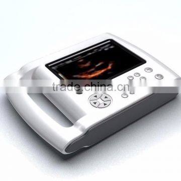 SLA 3d printer rapid prototype/sls nylon rapid prototype/cnc machining rapid prototype