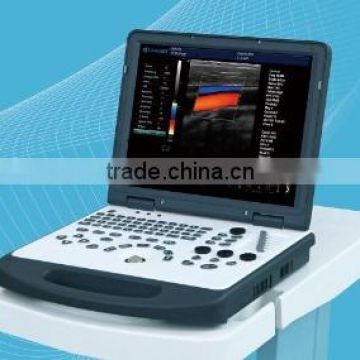 MC-DE-C60 3D laptop doppler color ultrasound scanner