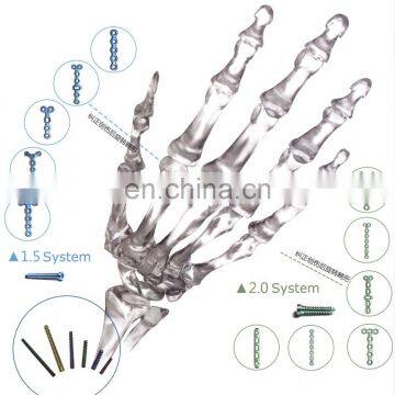 Orthopedic Locking Plates for Fixation of Mini Bone Fractures photo-3