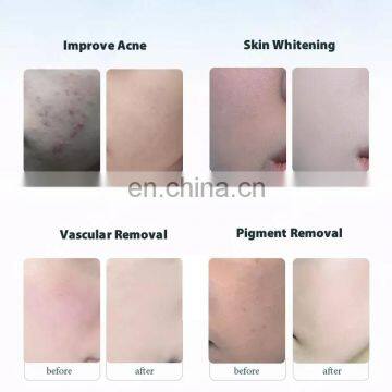 Wholesale 7 Color PDT LED Skin Care Facial Acne Removal Led Light Therapy Beauty Machine With Hot and Cold Stream Spray photo-5