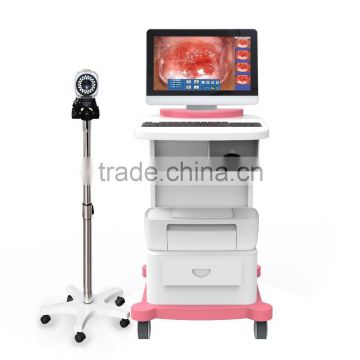 Cheap type Trolley Digital Video Colposcope / China Optical colposcope with CE