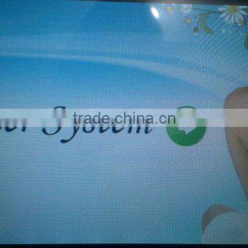 Varicose Veins Treatment Promotions Salon Clinical Q Switch Laser Tattoo Removal Machine Q Switched Nd Yag Laser photo-4