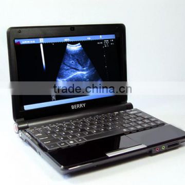 B ultrasound With Screen 10.1 LED portable ultrasound machine price cheaper                        
                                                                                Supplier's Choice