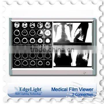 EdgeLight slim Medical Film Viewer