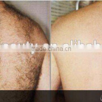 Portable IPL Shr Laser Permanent Hair Removal Machine