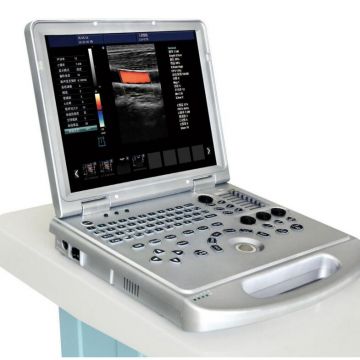 Echo Color Doppler 3D Function Laptop/Notebook Ultrasound