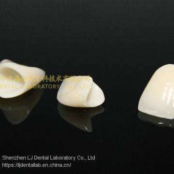 Dental Crown E.Max Ceramic, Porcelain Crown, Dental Veneers, Laboratoire Dentaire, Dentallabor, Laboratorio Dental, Dental Laboratory, Shenzhen LJ Dental Lab China photo-3