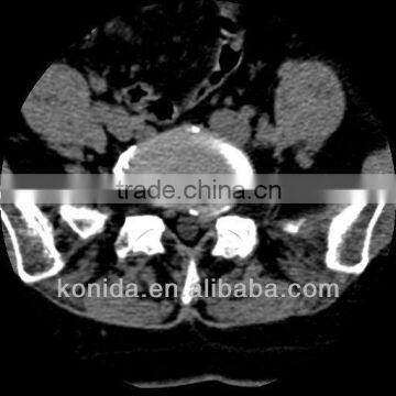medical diagnostic x-ray equipment,medical film x ray film,medical laser printing film