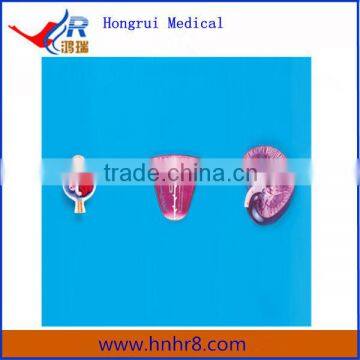 Human Enlarged Kidney, Nephron and Glomerulus Medical Anatomical Model