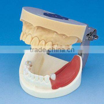 Typodont Orthodontic Model for Practicing teeth model factory