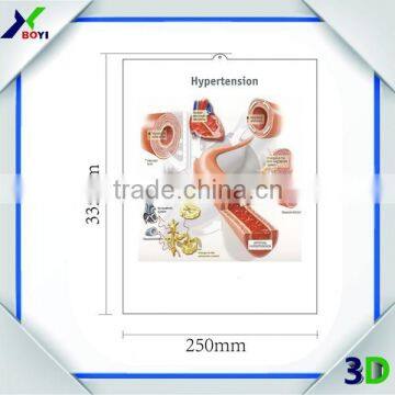 3D Plastic Medical Wall Posters, Customized 3D Anatomical Charts photo-4