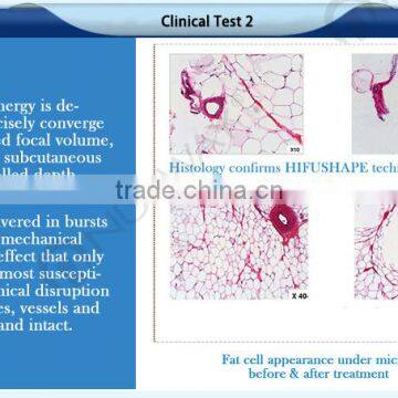 5 In 1 Cavitation Machine Beauty Equipment 1-10 Continuously Adjustable Cavitation Slimming Machine Ultrasonic Ultralift Hifu Skin Lifting photo-6