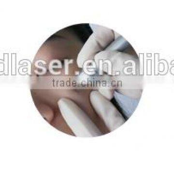 Hot Selling Q Switch Nd Yag Laser Multi-function Laser Removal Tattoo Machine Ipl Machine With Low Price Facial Veins Treatment photo-6