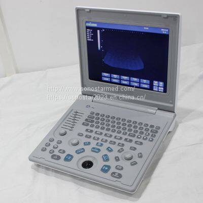 SS-6B Laptop All-Digital Ultrasound