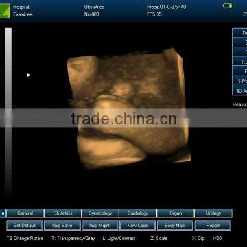 Portable Ultrasound Machine CU18A Made by Latest Color Ultrasoun Technology photo-2