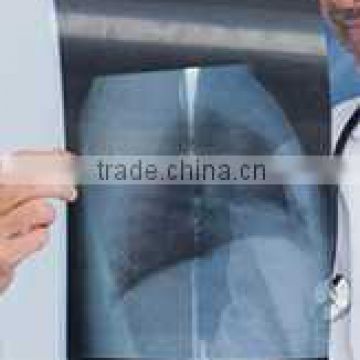 alibaba prices of x-ray thermal film, alibaba prices of agfa x-ray film 14x17