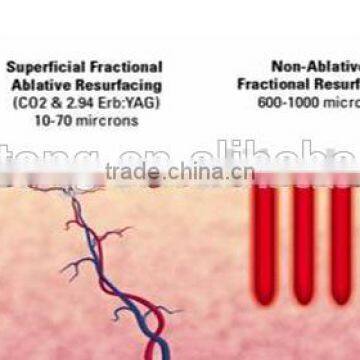 Improve Flexibility Wart Removal Vagina Tightening Used Beauty Birth 590-1200nm Mark Removal Salon Equipment For Sale Co2 Fractional Laser