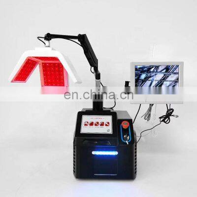 Led 650nm Laser Diode Hair Regrowth With Hair Follicle Detection Beauty Machine Anti Hair Loss Treatment Scalp Care System photo-5
