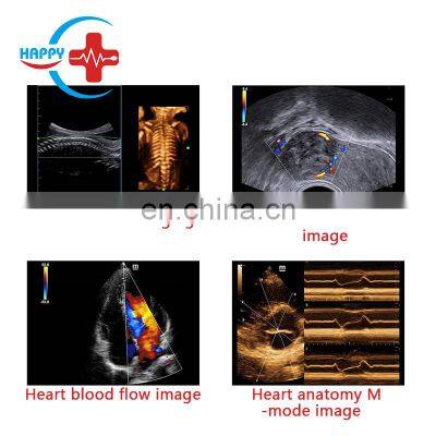 Best-selling Trolley Mindray Dc-40 Color Doppler Ultrasound Machine Portable Mindray Ultrasound Device
