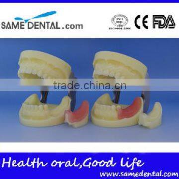 Dental Implant Practice Model DEA-31 Teeth Implant Models