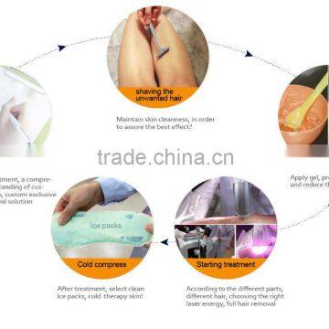 YUWEI Newest High Quality Ice No Pain 808 nm Diode Laser Hair Removal Machine photo-6