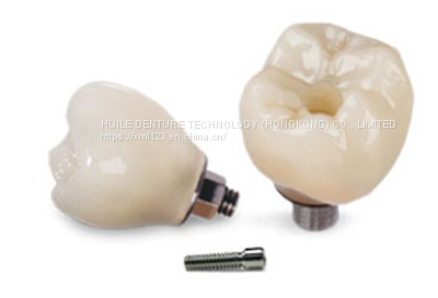 CROWNS AND BRIDGES China Dental Lab Chinese Dental Lab Dentallabor China