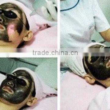 Pigment Removal Tattoo Removal About Portable Q-Switch Nd YAG Laser photo-6