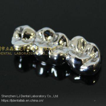 Full metal crown, FMC, FGC, full metal post core, dental crown, cast metal crown, dental prosthesis, laboratorio dental, dental laboratory, Dentallabor, LJ dental lab China