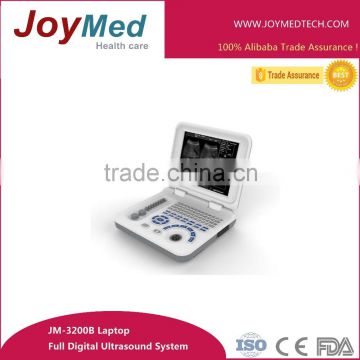 popular white B ultrasound scanner laptop ultrasound scan