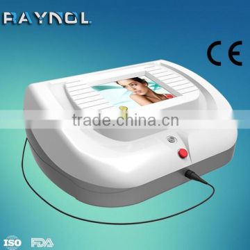 2015 Best Price Skin Tag Removal 30MHz RBS Spider Vein Removal Machine