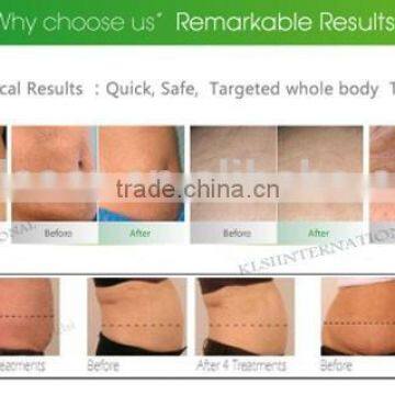 Fat Cavitation Machine RF Beauty Salon Equipment / Cavitation Machine / Slimming Machine 2mhz photo-4