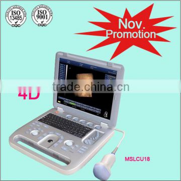 (MSLCU18)Latest handheld Laptop Color Doppler Medical Ultrasound Scan Machine 3D 4D