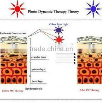 Anti-aging470nm Red Skin Care Machine Pdt/ Facial Led Light Led Light For Skin Care Therapy Led Light Skin Rejuvenation Equipment Skin Tightening Skin Lifting photo-5