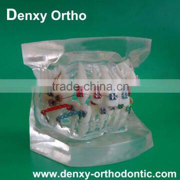 ceramic / sapphire / metal bracket dental learning orthodontic models