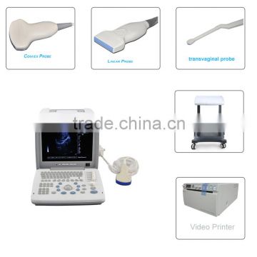 CE approved Portable B-Mode Ultrasound Scanner with 3.5Mhz multi-frequency convex probe RUS-9000B