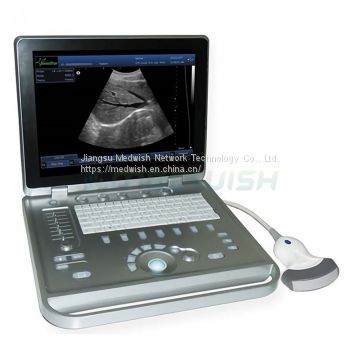 AG-BU009 Portable Handheld Human Medical Electronic Ultrasound Scanner China