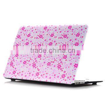 New Ideas 2016 Laptop Case Plastic Protective Sleeve for Macbook photo-3