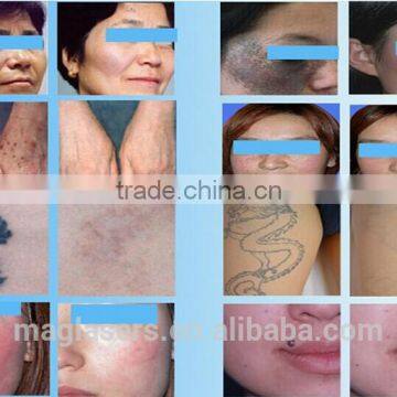 0.1-2.6mm Multifunction Dermatology Sc-2 Laser Co2 Fractional Machine Ultra Pulse photo-6