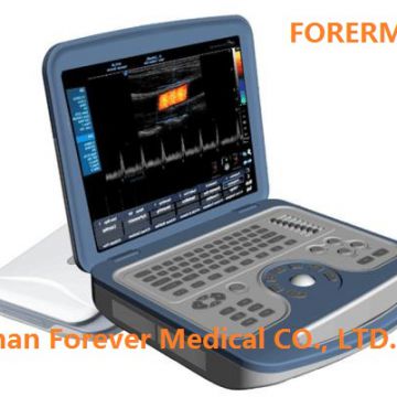 Portable Ultrasound Color Doppler Gynaecology Ultrasound