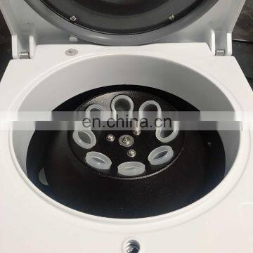 Small Size Portable Laboratory PRP Centrifuge Machine photo-6