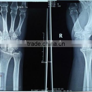 fuji medical x-ray film, x-ray blue film from zhejiang hangzhou