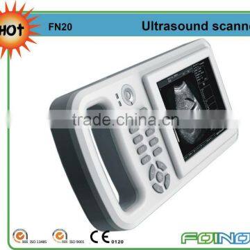 FN20 Handheld ipad ultrasound scanner with CE