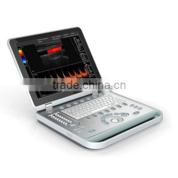 3D 4D Portable Color Doppler Ultrasound Machine C5