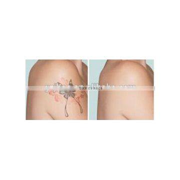 Portable Nd Yag Laser Vascular Tumours Treatment Tatoo Removal/Pigment Removal Machine 1 HZ