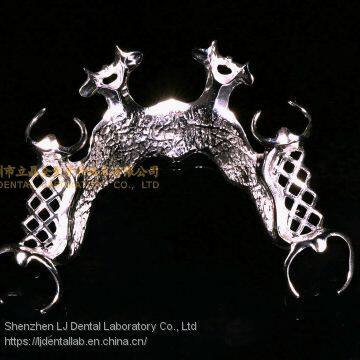 Dental Co-Cr partial denture,Titanium framework denture, dental dentures, laboratoire dentaire, Dentallabor, laboratorio dental, dental laboratory, Shenzhen LJ dental lab China