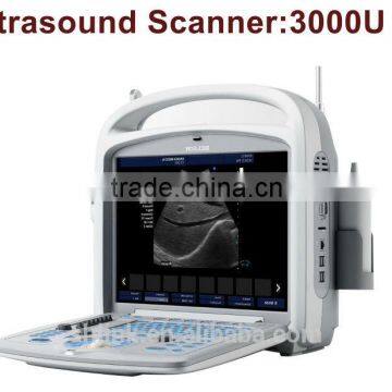 fine low price Digital portable ultrasound scanner